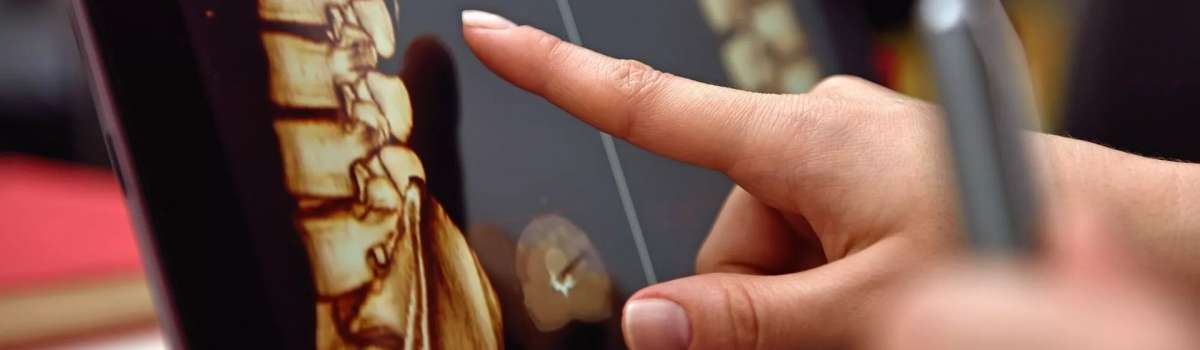 Ανάλυση Στάσης Σώματος